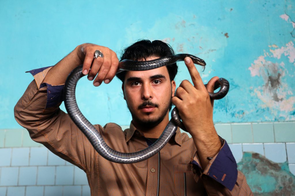 רופאים שלפו נחש באורך של יותר ממטר מבטנו של אדם • הכותרות שהעסיקו היום את העולם