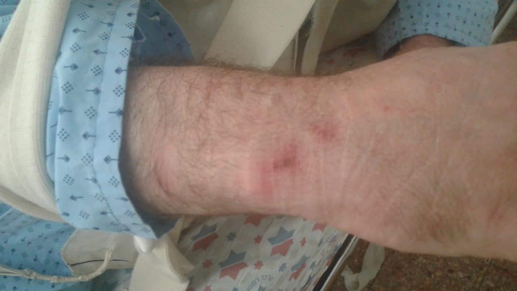 האברך שוכב פצוע "השוטר הכה אותי כי צילמתי"