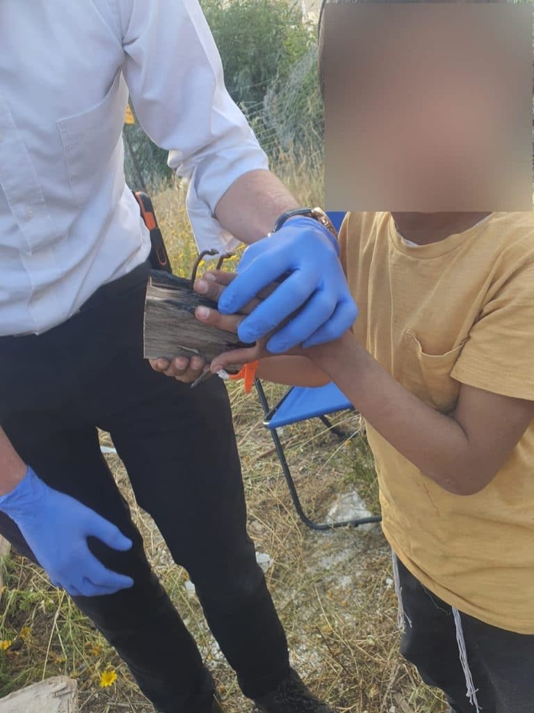 במהלך איסוף קרשים לל"ג בעומר: לוחמי האש חילצו ידו של ילד ממשטח עץ