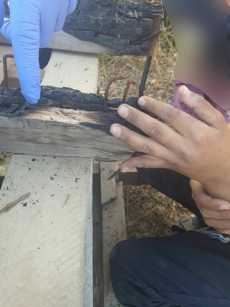 במהלך איסוף קרשים לל"ג בעומר: לוחמי האש חילצו ידו של ילד ממשטח עץ