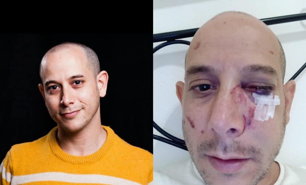 אנטישמיות באיטליה: מהגר תקף ישראלי בגלל "היהודים הרוצחים"