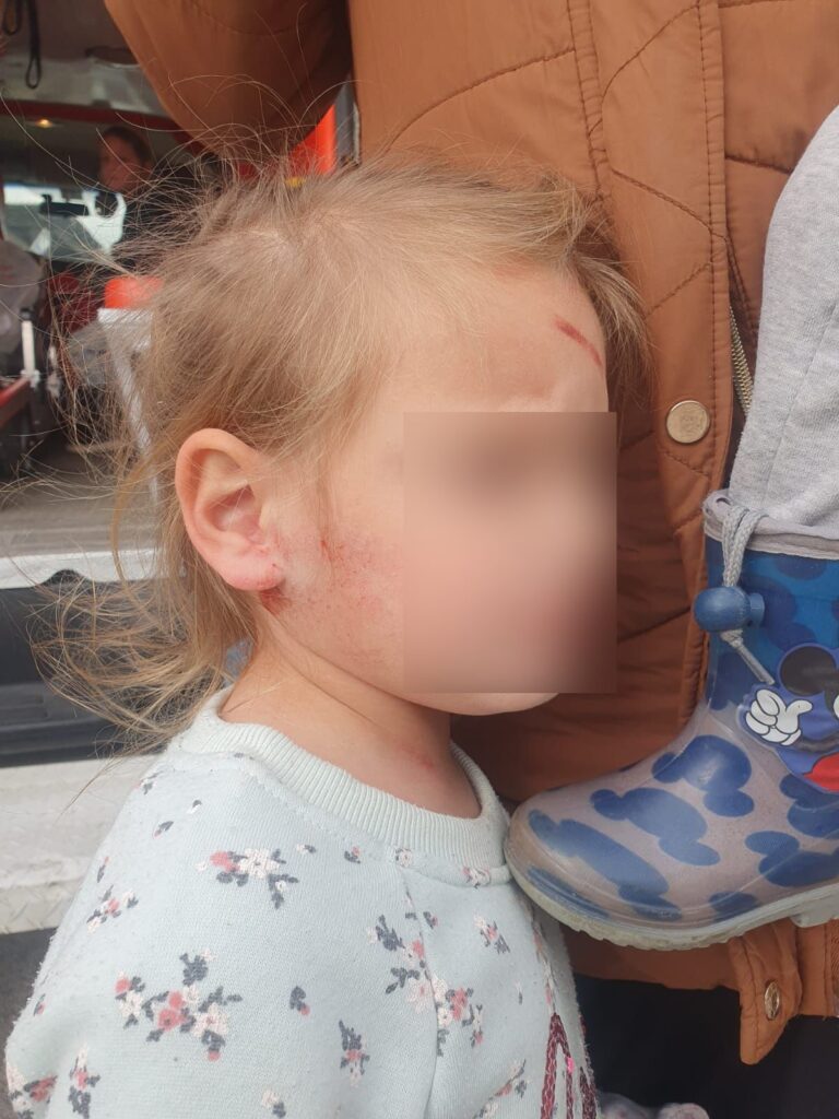 זה היה ניסיון רצח: שלושה ילדים יהודים נפצעו בפיגוע אבנים בחווארה