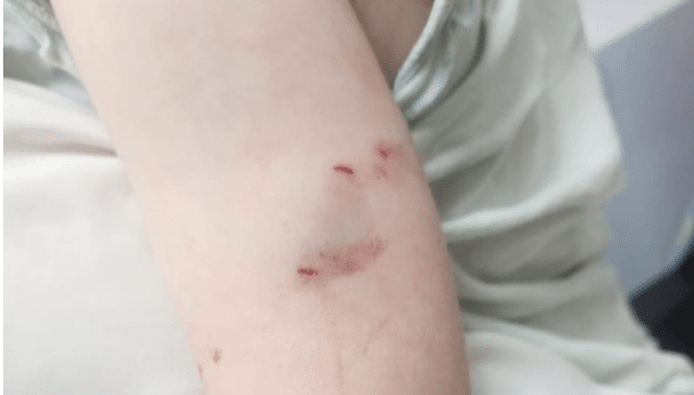 במעיני הישועה נדהמו: פעוטה ננשכה על ידי חולדה