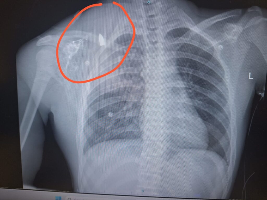 בליל שבת: המג"ד השתולל, איים ונער בן 14 נפצע מירי חי בליל שבת: המג"ד השתולל, איים ונער בן 14 נפצע מירי חי