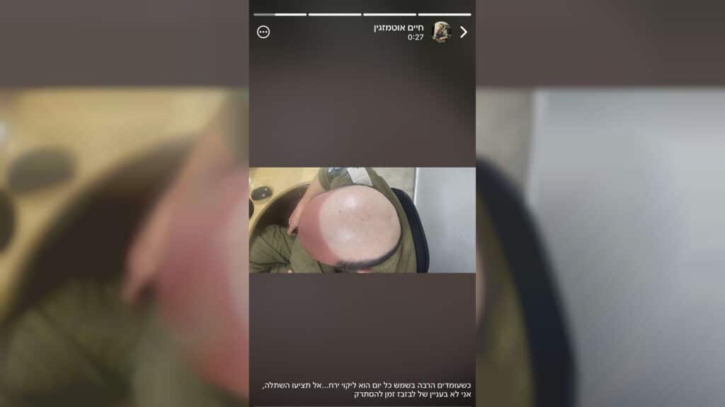 איצקוביץ': הבכיר החרדי שהתפטר והעניבה של היח"צן