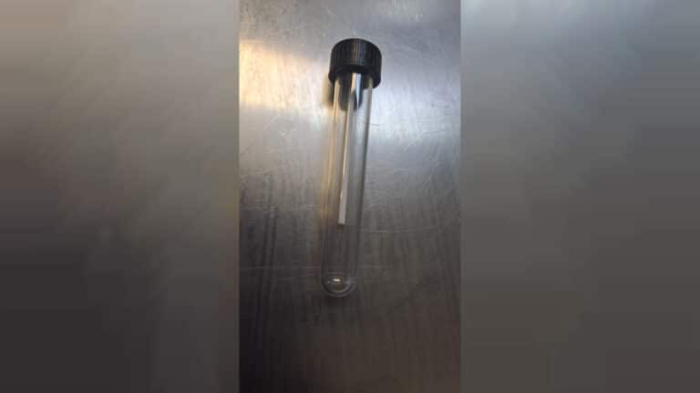 בת 7 בלעה סוכרייה עם המקל – וניצלה בחדר הניתוח