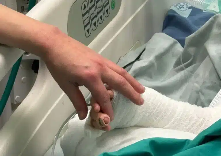 אירוע קשה בביהכנ"ס: ילד בן 4 נפל לתוך סיר מרק רותח