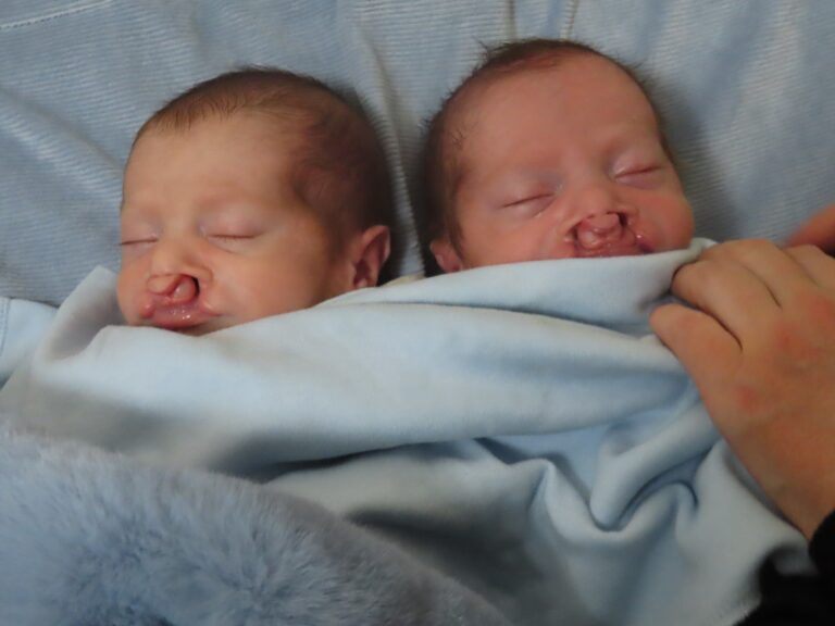 "אם לא נגייס 80,000$ – לא תהיה להם הזדמנות נוספת"