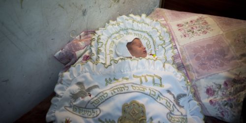 ברית מילה | למצולם אין קשר לכתבה צילום פלאש 90