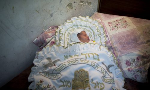 ברית מילה | למצולם אין קשר לכתבה צילום פלאש 90
