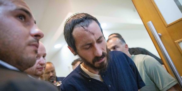 פצוע הלינץ' בבורקא, יחיאל אינדור. צילום: חיים גולדברג/פלאש 90