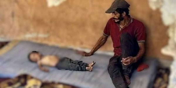 פייק רעב. אחת התמונות שהתבררו כשקריות. צילום: רשתות פלסטיניות