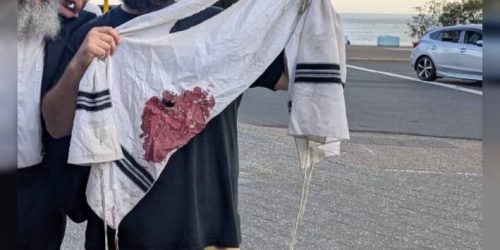 ציצית מוכתמת בדם אחרי הירי באוסטרליה  צילום: לפי סעיף 27א'