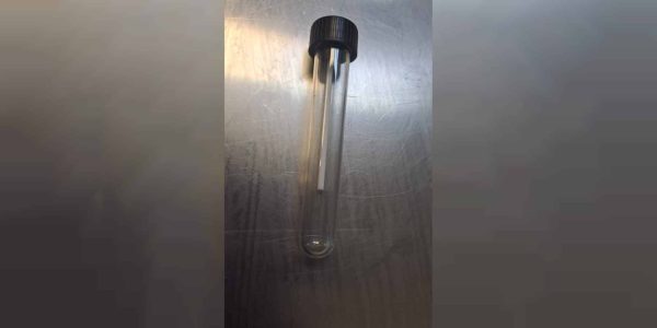 צילום: הדסה