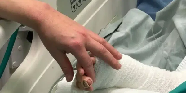 צילום: דוברות הדסה