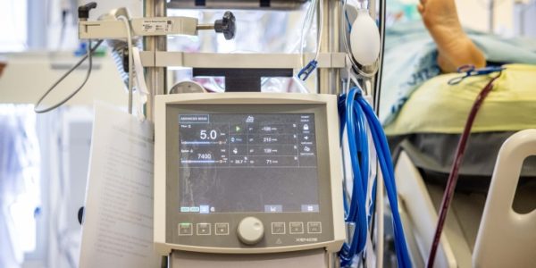 מכונת אקמו ביחידה לטיפול נמרץ בבית החולים שערי צדק. צילום: יונתן סינדל / פלאש 90