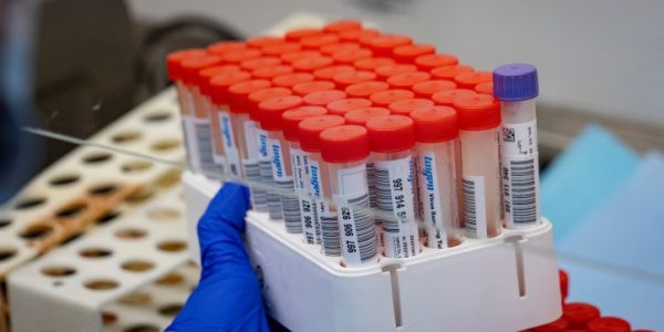 בדיקות קורונה שהגיעו למעבדה /// צילום: Olivier Fitoussi/Flash90